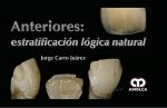 ANTERIORES ESTRATIFICACION LOGICA NATURAL
