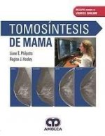 TOMOSINTESIS DE MAMA