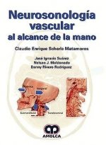 NEUROSONOLOGIA VASCULAR