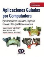 APLICACIONES GUIADAS POR COMPUTADORA PARA IMPLANTES DENTALE