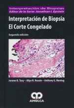 Interpretación de biopsia
