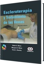 Escleroterapia y tratamiento de las venas