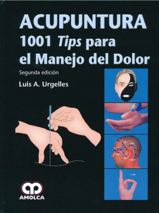 ACUPUNTURA 1001 TIPS PARA EL MANEJO DEL DOLOR