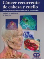 CANCER RECURRENTE DE CABEZA Y CUELLO