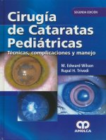 CIRUGIA DE CATARATAS PEDIATRICAS COMPLICACIONES Y MANEJO