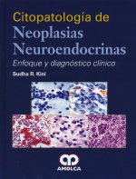 CITOPATOLOGIA DE NEOPLASIAS NEUROENDOCRINAS