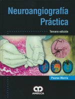 NEUROANGIOGRAFIA PRACTICA