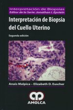 Interpretación de biopsia del cuello uterino