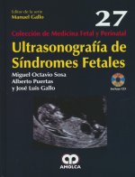 Ultrasonograf­a de s­ndromes fetales
