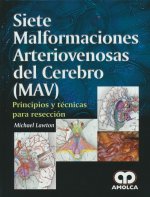 SIETE MALFORMACIONES ARTERIOVENOSAS DEL CEREBRO PRINCIPIOS