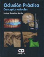 OCLUSION PRACTICA
