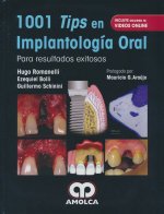 1001 TIPS IMPLANTOLOGIA ORAL PARA RESULTADOS EXITOSOS VIDEO