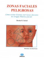 ZONAS FACIALES PELIGROSAS. COMO EVITAR LESIONES NERVIOSAS