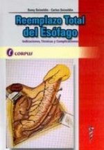 REEMPLAZO TOTAL DEL ESOFAGO