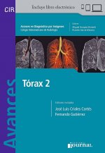 AVANCES EN DIAGNOSTICO POR IMAGENES 17 TORAX 2