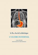 b.a.-ba de la dietetique pour l'ulcere duodenal