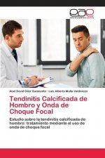 Tendinitis Calcificada de Hombro y Onda de Choque Focal