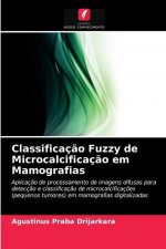 Classificacao Fuzzy de Microcalcificacao em Mamografias
