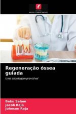 Regeneracao ossea guiada