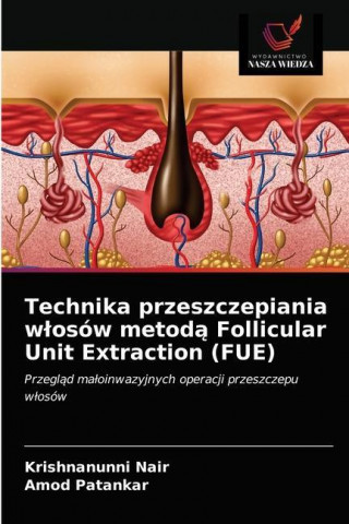 Technika przeszczepiania wlosow metodą Follicular Unit Extraction (FUE) (Nair Krishnanunni Nair,Patankar Amod Patankar)()