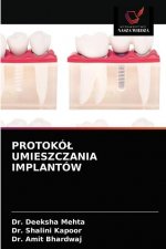 Protokol Umieszczania Implantow