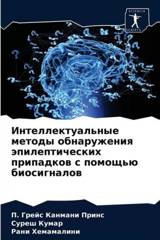Интеллектуальные метод&#