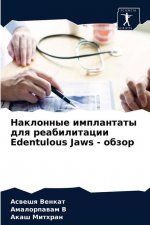 Наклонные имплантаты дл&