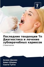 Последние тенденции Tn Диk