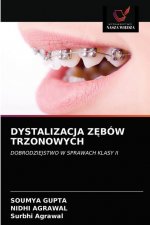 Dystalizacja ZĘbow Trzonowych
