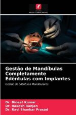 Gestao de Mandibulas Completamente Edentulas com Implantes