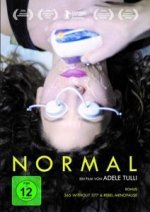 Normal