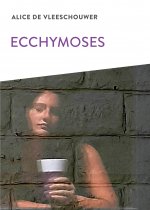Ecchymoses