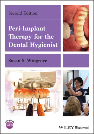 Peri-Implant Therapy for the Dental Hygienist (Brožovaná)
