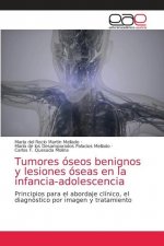 Tumores oseos benignos y lesiones oseas en la infancia-adolescencia
