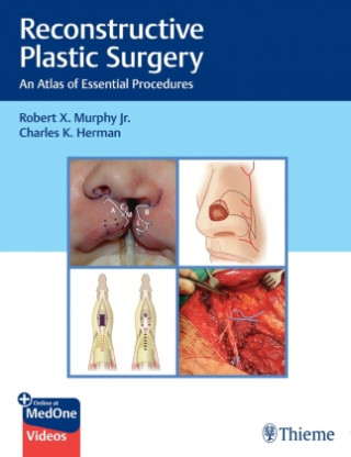 Reconstructive Plastic Surgery (Charles Herman)()