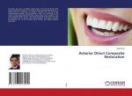 Anterior Direct Composite Restoration