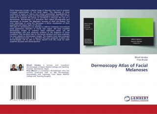 Dermoscopy Atlas of Facial Melanoses
