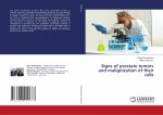 Signs of prostate tumors and malignization of their cells