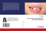 Prosthodontic Management of Partial Anodontia