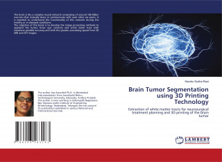 Brain Tumor Segmentation using 3D Printing Technology