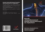 Rozwoj zmineralizowanych powlok bioceramicznych na implantach