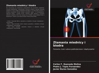 Zlamania miednicy i biodra