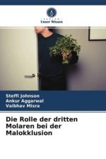 Die Rolle der dritten Molaren bei der Malokklusion