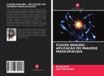 FUSION IMAGING - APLICAÇ?O EM IMAGENS MAXILOFACIAIS