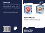 KRIOSEKCIYa