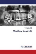 Maxillary Sinus Lift