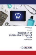 Restoration of Endodontically Treated Teeth