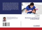 Mechanism and Diagnosis of Dental Caries