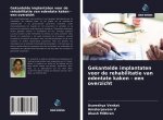 Gekantelde implantaten voor de rehabilitatie van edentate kaken - een overzicht