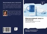 Maxillqrnyj sinus i patologii